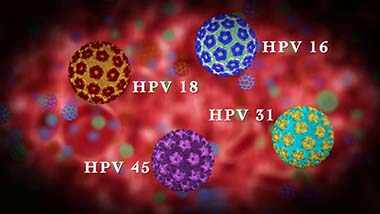 Khí hư ra nhiều do nhiễm virut HPV
